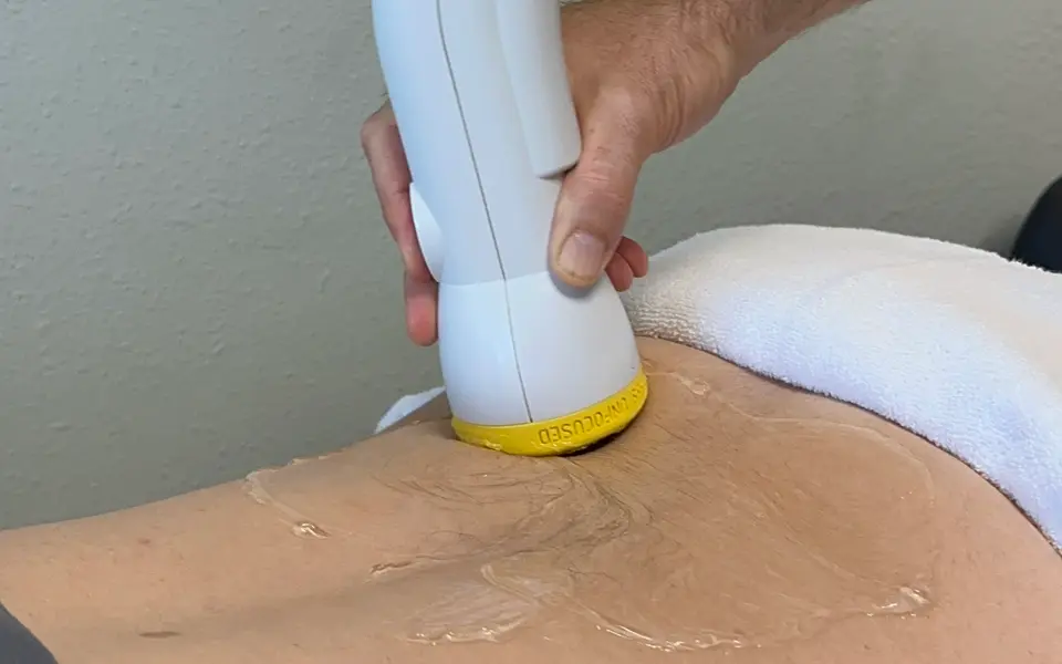 Close-up of the SoftWave applicator on a patient's lower back with conductive gel