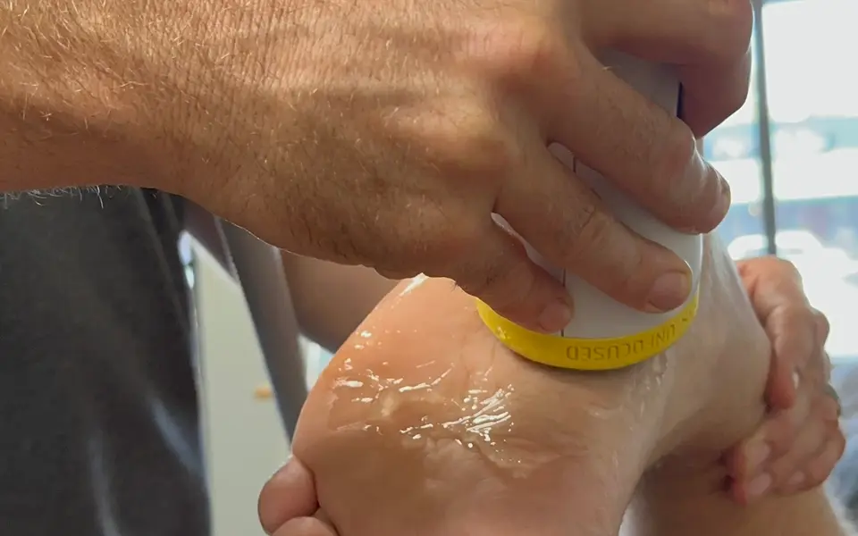 SoftWave applicator treating the heel and arch of a patient's foot
