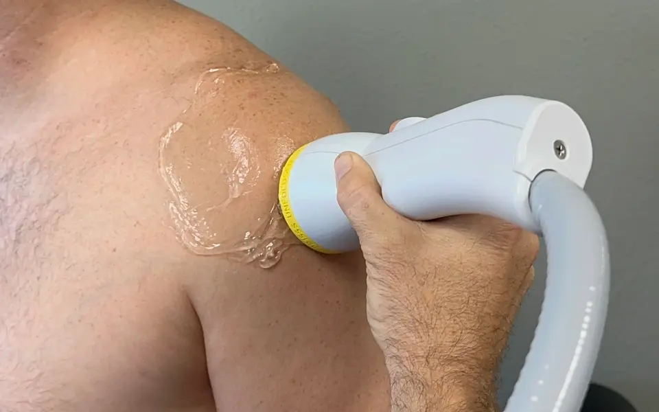 SoftWave applicator treating a patient's shoulder